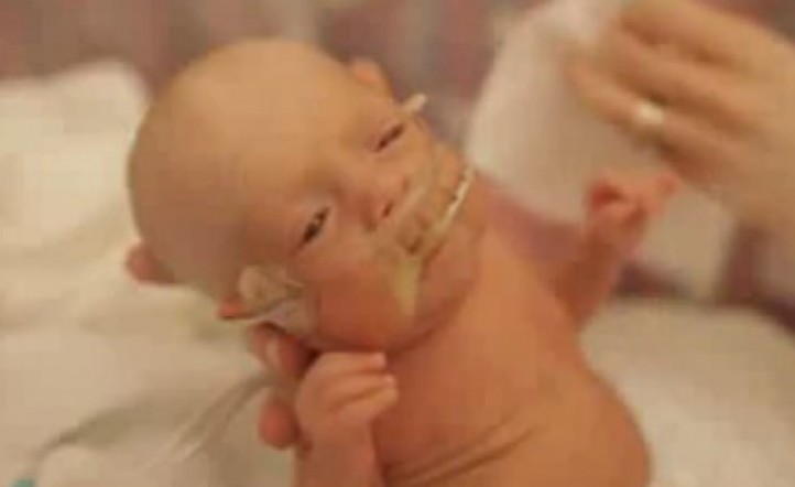 El Video Del Bebe Prematuro Que Conmueve Al Mundo Infoveloz Com