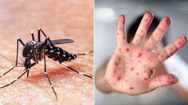 dengue y sarampión