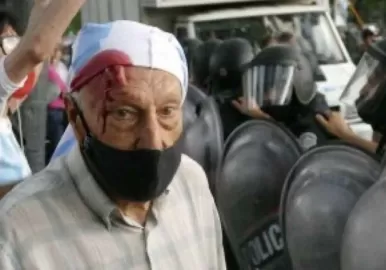 jubilado golpeado marcha