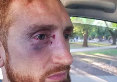 Reinick basquet golpiza golpeado campazzo