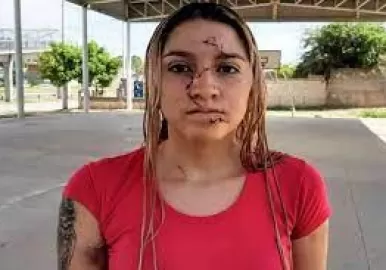 atacaron-botella-joven-cordoba