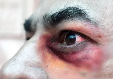 hongo-negro-argentina