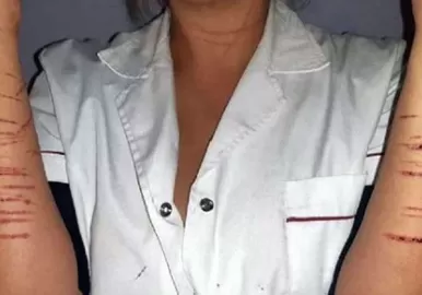 ataque sexual mar del plata