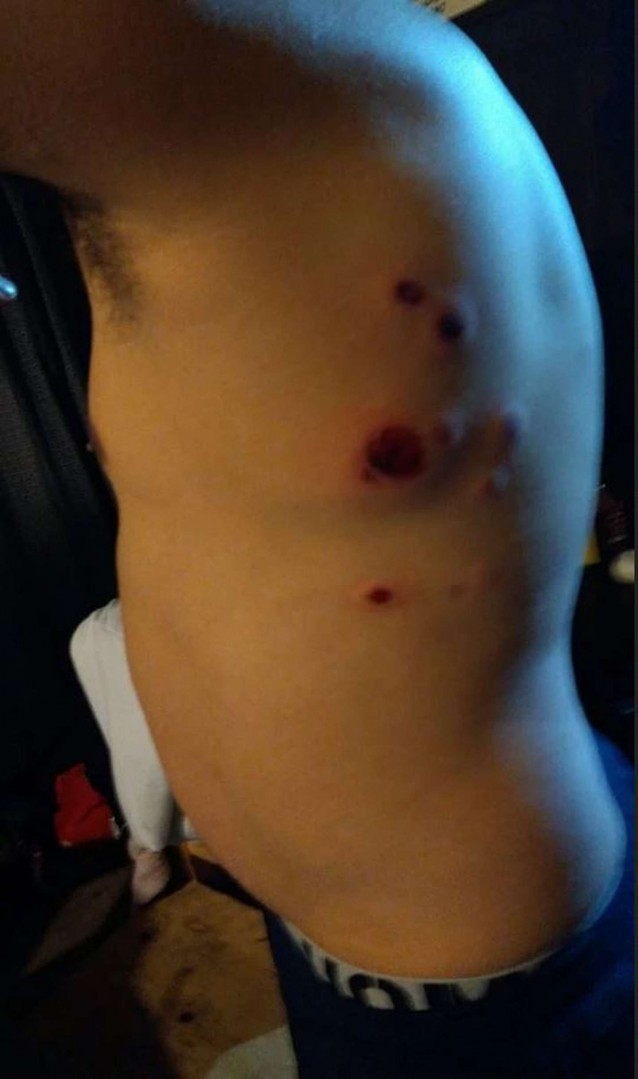 brote psicotico mar del plata