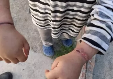 nene golpeado moreno