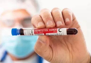 hepatitis