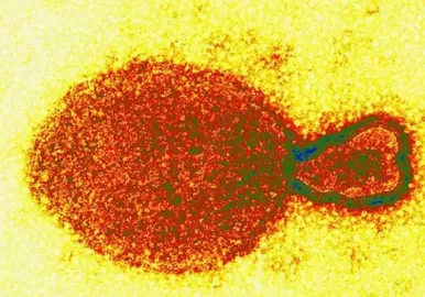 henipavirus