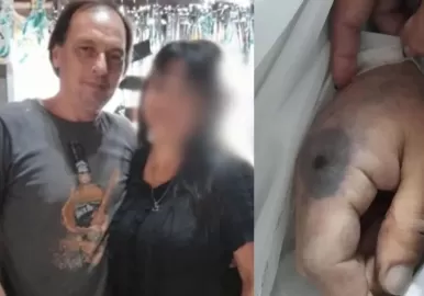 hombre muerto por araña de rincon