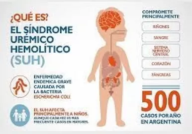 sindrome uremico hemolitico