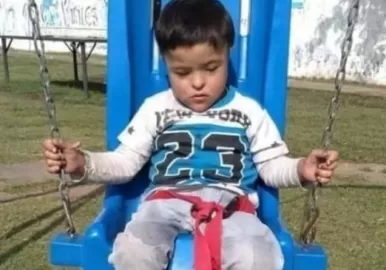 merlo sindrome de down