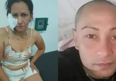 le arranco la oreja a la novia