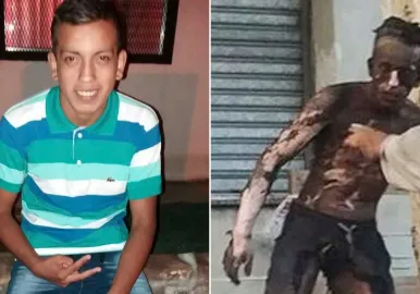 joven quemado rosario
