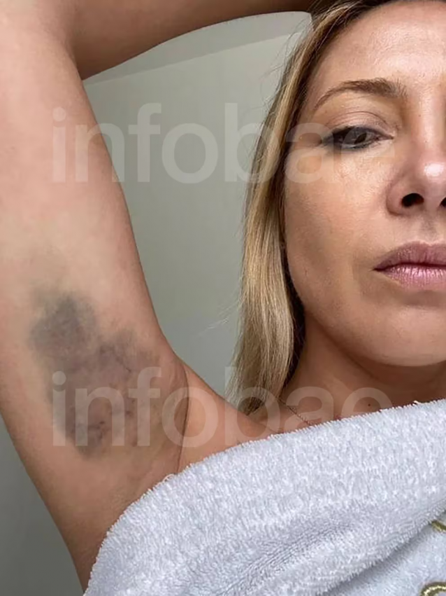 fabiola golpeada chats