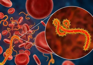 ebola